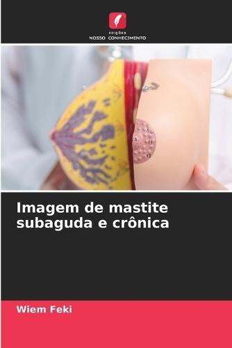 Imagem de mastite subaguda e crônica
