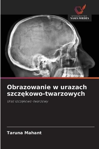 Obrazowanie w urazach szcz&#281;kowo-twarzowych