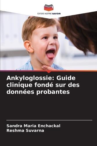 Ankyloglossie: Guide clinique fondé sur des données probantes