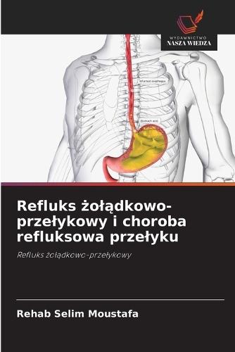 Refluks &#380;ol&#261;dkowo-przelykowy i choroba refluksowa przelyku