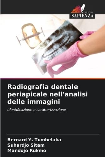 Radiografia dentale periapicale nell'analisi delle immagini