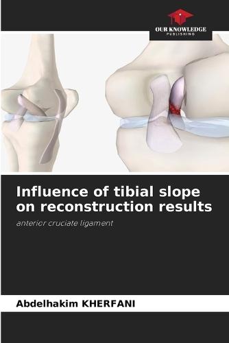 Influence of tibial slope on reconstruction results