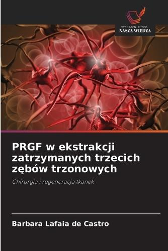 PRGF w ekstrakcji zatrzymanych trzecich zębów trzonowych