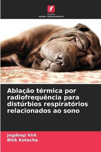 Ablação térmica por radiofrequência para distúrbios respiratórios relacionados ao sono