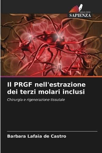 Il PRGF nell'estrazione dei terzi molari inclusi