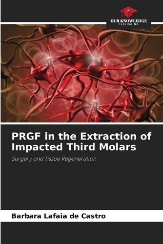 PRGF in the Extraction of Impacted Third Molars