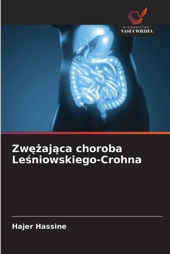 Zwężająca choroba Leśniowskiego-Crohna