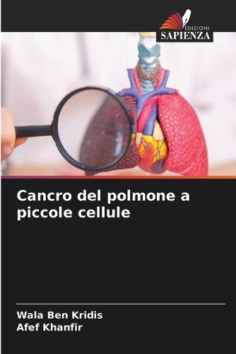 Cancro del polmone a piccole cellule