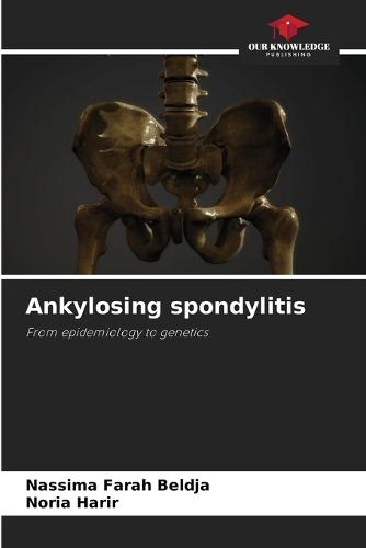 Ankylosing spondylitis