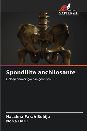 Spondilite anchilosante