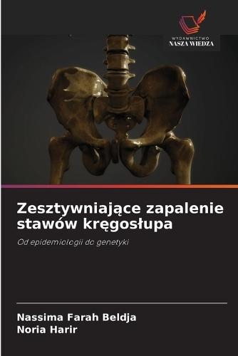 Zesztywniające zapalenie stawów kręgoslupa