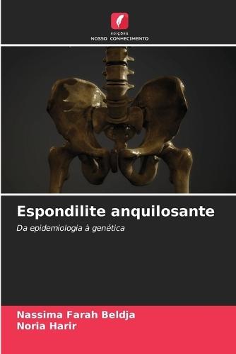 Espondilite anquilosante