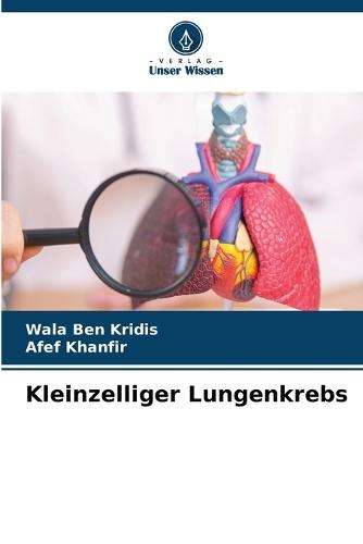 Kleinzelliger Lungenkrebs