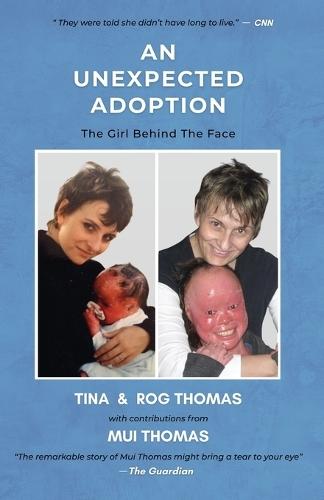 An Unexpected Adoption: The Girl Behind The Face