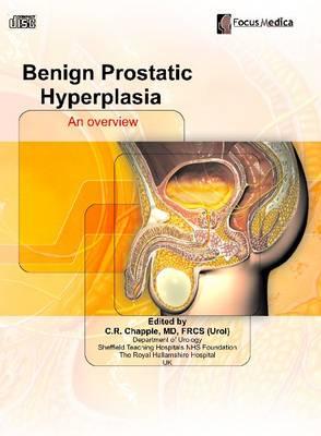 Benign Prostatic Hyperplasia: An Overview