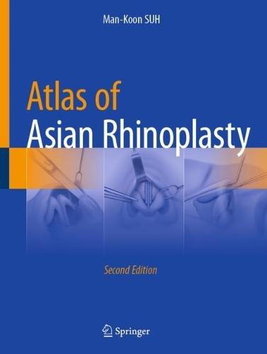 Atlas of Asian Rhinoplasty