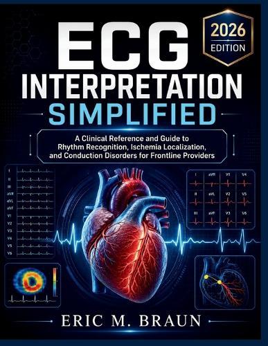 ECG Interpretation Simplified: A Clinical Reference and Guide to Rhythm Recognition, Ischemia Localization, and Conduction Disorders for Frontline Providers