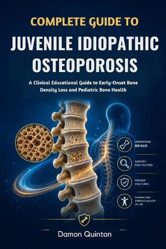 Complete Guide To Juvenile Idiopathic Osteoporosis: A Clinical Educational Guide to Early-Onset Bone Density Loss and Pediatric Bone Health