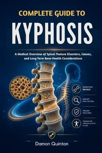 Complete Guide To Kyphosis: A Medical Overview of Spinal Posture Disorders, Causes, and Long-Term Bone Health Considerations