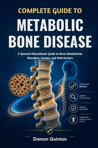 Complete Guide To Metabolic Bone Disease: A General Educational Guide to Bone Metabolism Disorders, Causes, and Risk Factors