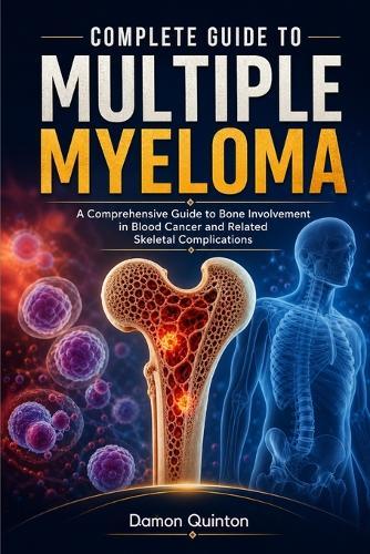 Complete Guide To Multiple Myeloma: A Comprehensive Guide to Bone Involvement in Blood Cancer and Related Skeletal Complications