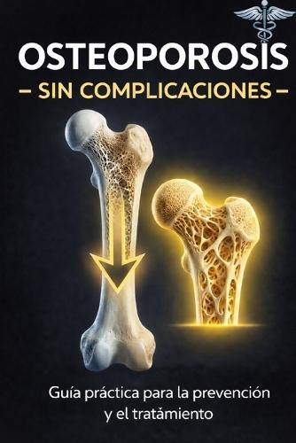 Osteoporosis: Sin Complicaciones