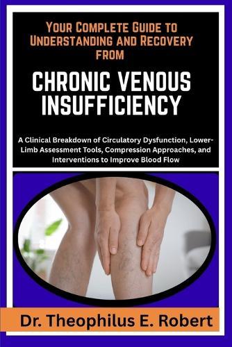 Your Complete Guide to Understanding and Recovery from Chronic Venous Insufficiency: A Clinical Breakdown of Circulatory Dysfunction, Lower-Limb Assessment Tools, Compression Approaches, and Interventions to Improve Blood Flow