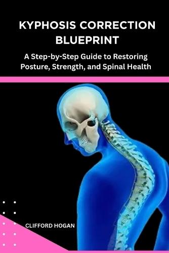 Kyphosis Correction Blueprint: A Step-by-Step Guide to Restoring Posture, Strength, and Spinal Health