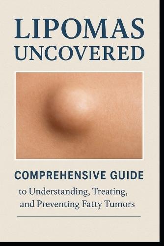Lipomas Uncovered: Comprehensive guide to understanding, treating and preventing fatty tumors.