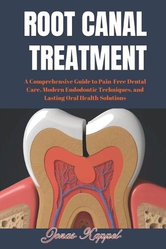 Root Canal Treatment: A Comprehensive Guide to Pain-Free Dental Care, Modern Endodontic Techniques, and Lasting Oral Health Solutions