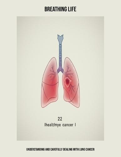 Breathing Life: Understanding And Carefully Dealing With Lung Cancer