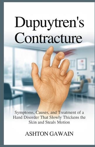 Dupuytren's Contracture: Symptoms, Causes, and Treatment of a Hand Disorder That Slowly Thickens the Skin and Steals Motion