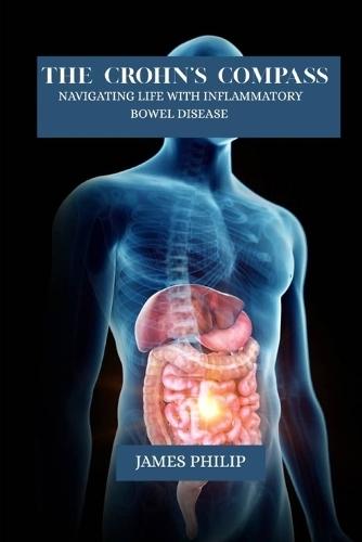The crohn's compass: Navigating life with inflammatory bowel disease