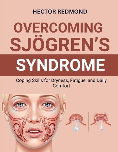 Overcoming Sjögren's Syndrome: Coping Skills for Dryness, Fatigue, and Daily Comfort