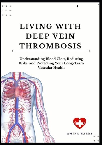 Living with Deep Vein Thrombosis: Understanding Blood Clots, Reducing Risks, and Protecting Your Long-Term Vascular Health