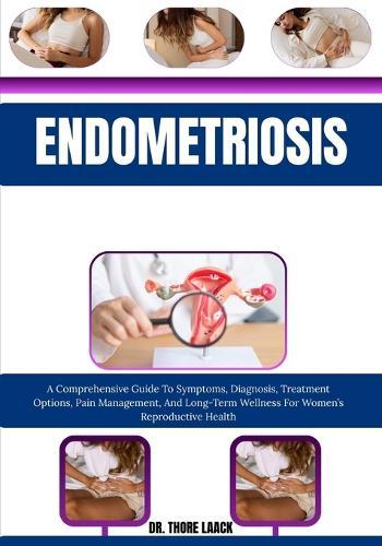 Endometriosis: A Comprehensive Guide To Symptoms, Diagnosis, Treatment Options, Pain Management, And Long-Term Wellness For Women's Reproductive Health