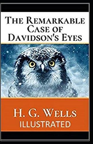 The Remarkable Case of Davidsons Eyes Illustrated