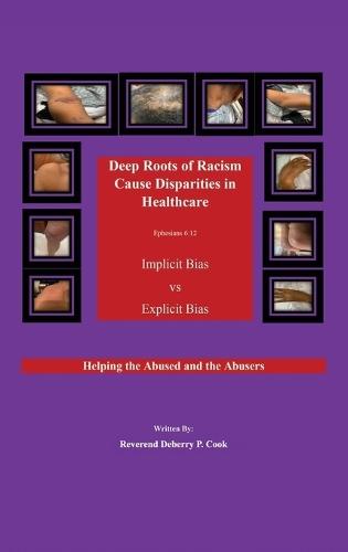 Deep Roots of Racism Cause Disparities in Healthcare: Implicit Bias vs Explicit Bias: Helping Both the Abused and the Abusers