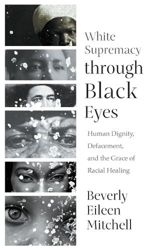 White Supremacy through Black Eyes: Human Dignity, Defacement, and the Grace of Racial Healing